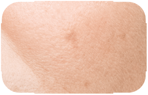 After image
