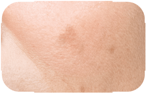 Before image