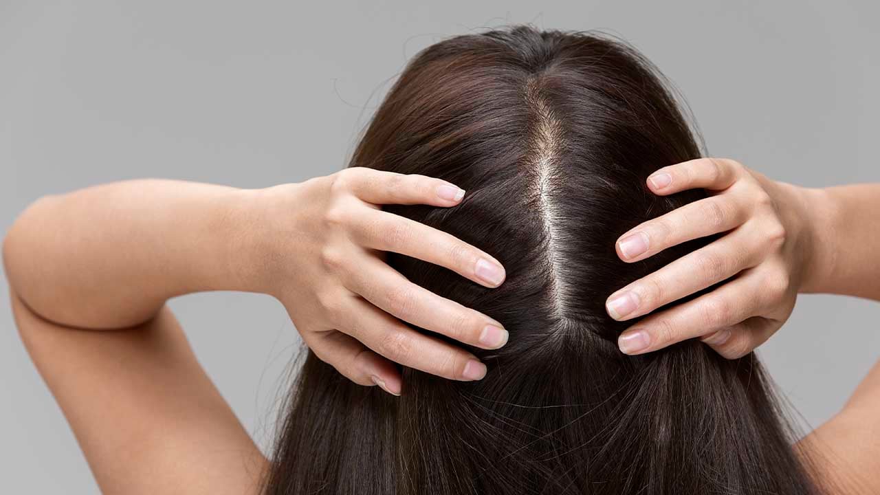Как устранить перхоть при сухой коже головы?