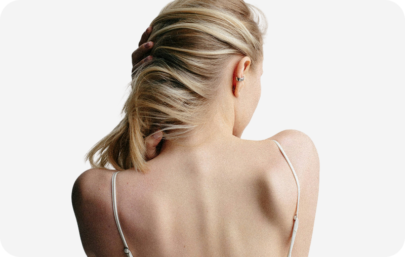 Как устранить перхоть при сухой коже головы?