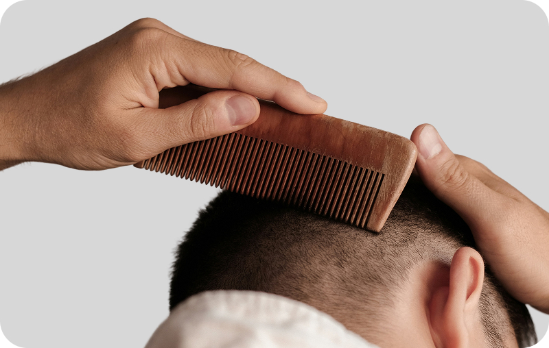 Перхоть: причины и симптомы появления