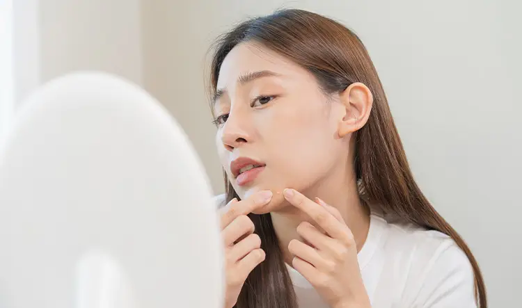 Почему появляются прыщи на подбородке?