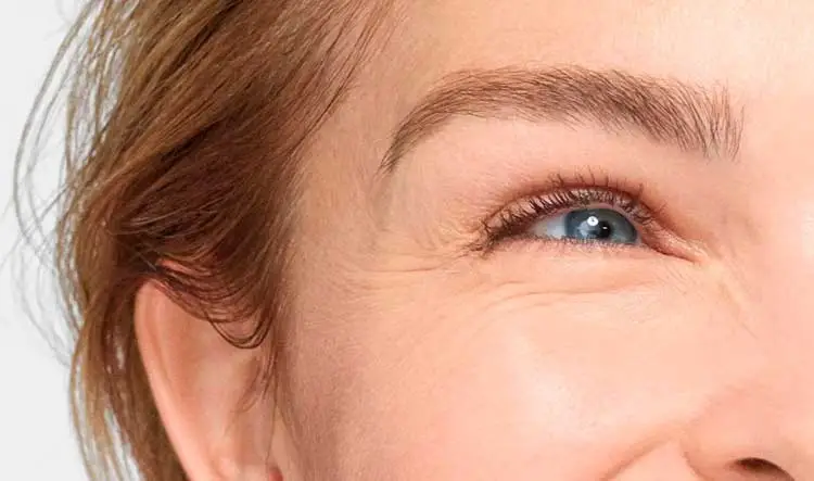 Как сделать мешки под глазами менее заметными