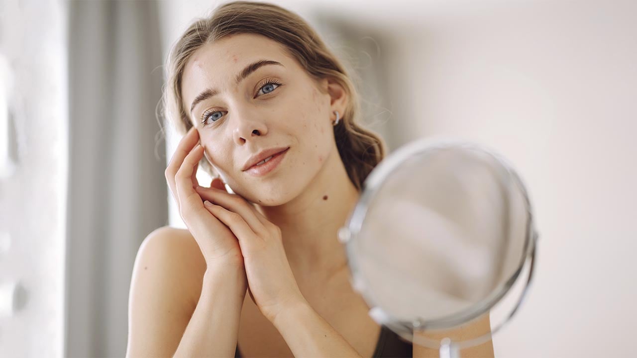 Рубцы постакне и поствоспалительная пигментация: чем отличаются и можно ли от них избавиться полностью?