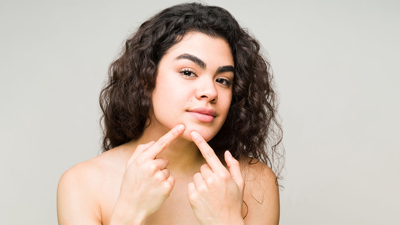 Комедоны: что это такое, почему появляются и как с ними справиться