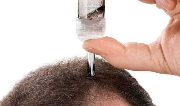 Значительные потери: как предотвратить выпадение волос у мужчин?