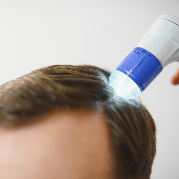 Диагностика алопеции у мужчин