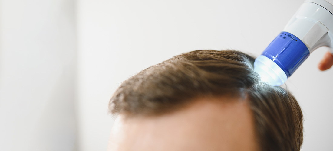 Диагностика алопеции у мужчин