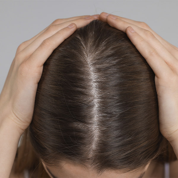 салициловая кислота от жирности кожи головы