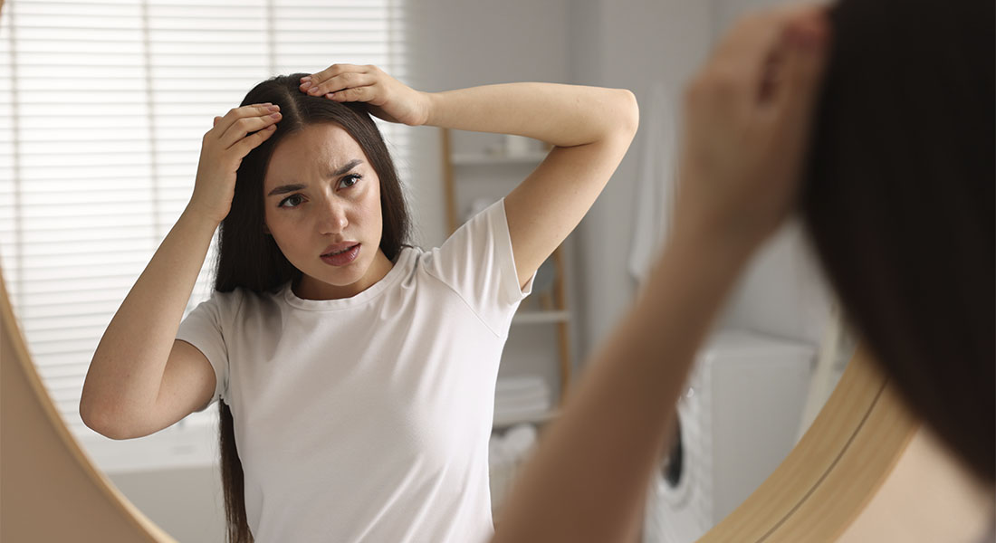 Признаки сухой себореи кожи головы