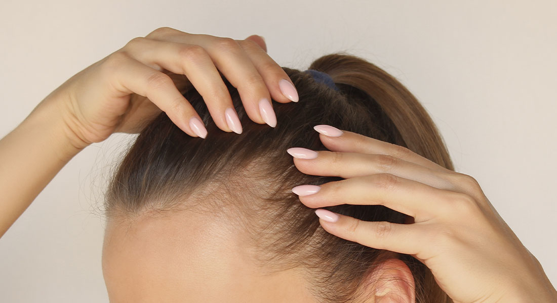 Как лечить сухую себорею кожи головы