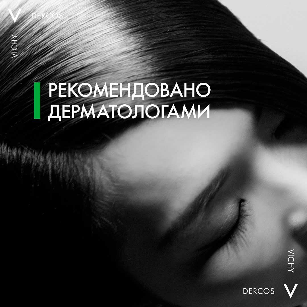 алопеция у женщин