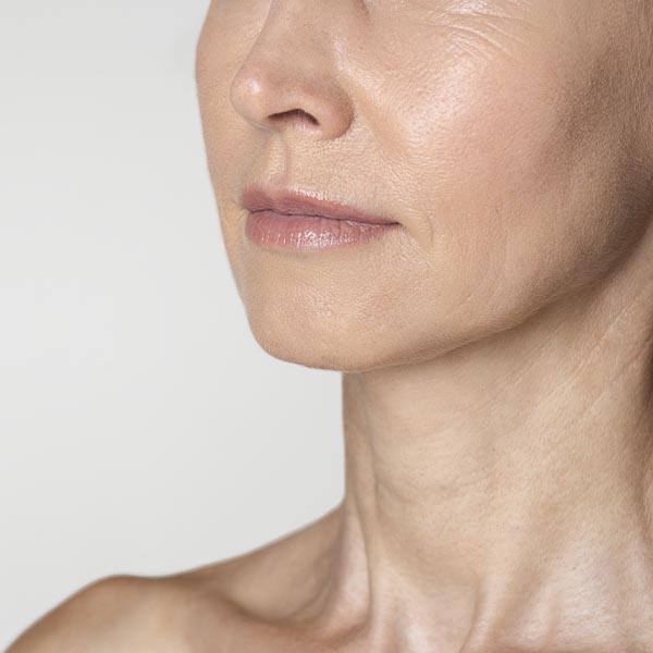 возрастные изменения кожи